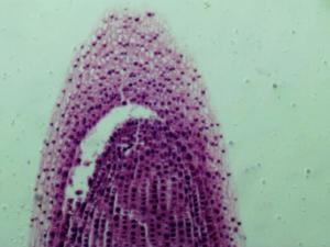 Onion Root Tip - 40x