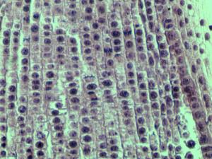 Onion Root Tip Mitosis - 100x